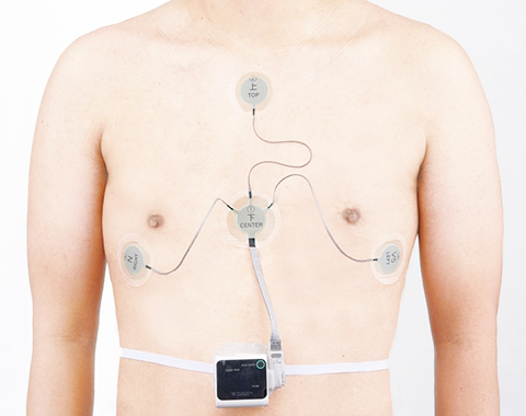 ホルター心電図